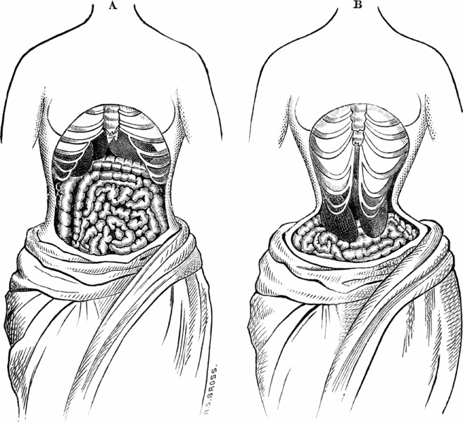 Death By Corset A Nineteenth Century Book About Fatal Women S Fashions And Animal Physiology Biodiversity Heritage Library