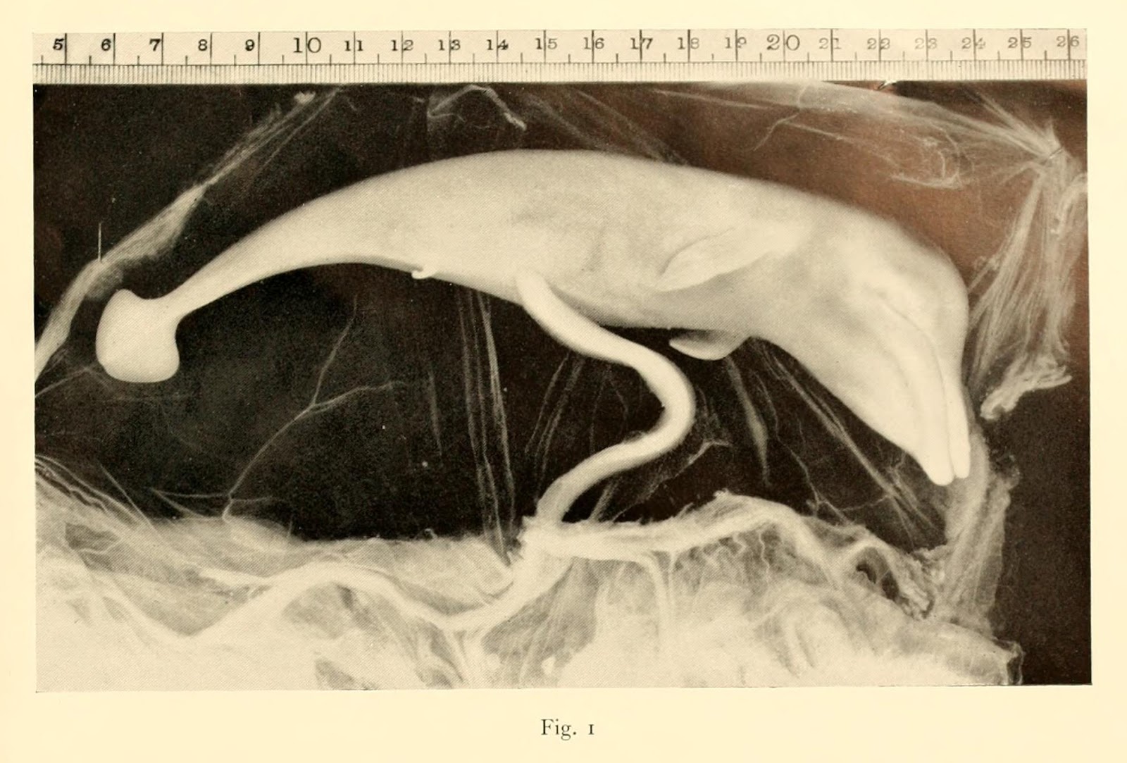 REPRODUCTION, GROWTH AND AGE OF SOUTHERN FIN WHALES By R. M. Laws (Plates  IV-VII and Text-figs. 1-60) GENERAL CONSIDERATIONS Introduction In his  paper on the southern stocks of whalebone whales, Mackintosh (