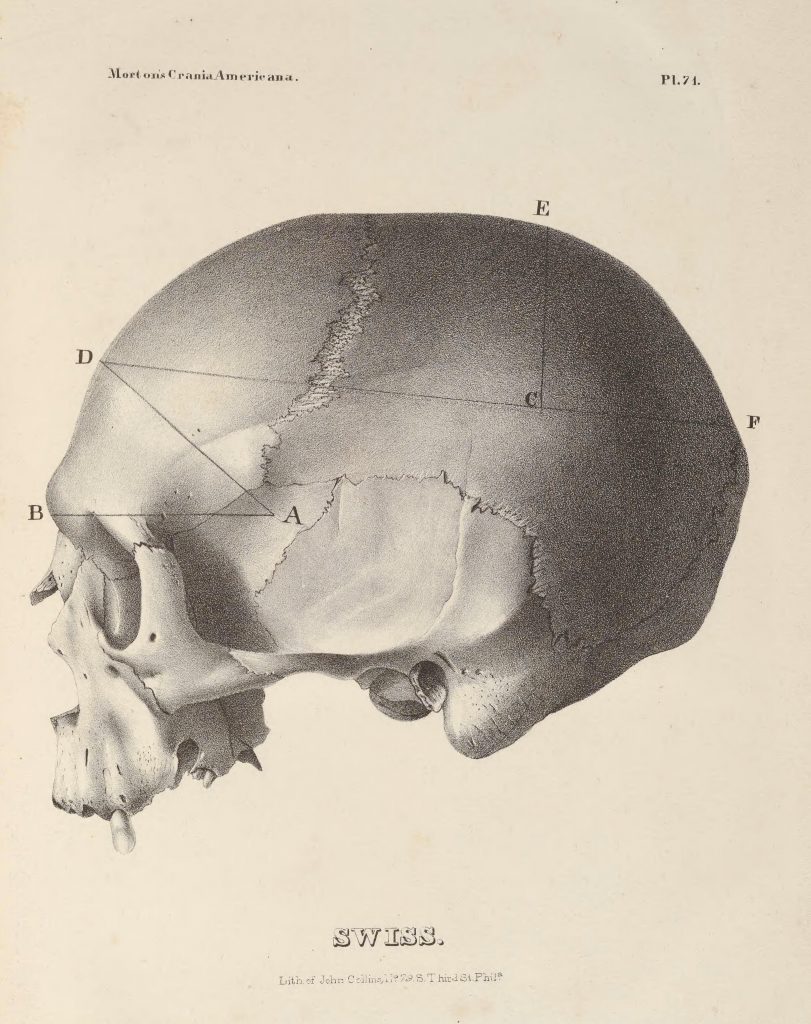 Illustration of a skull